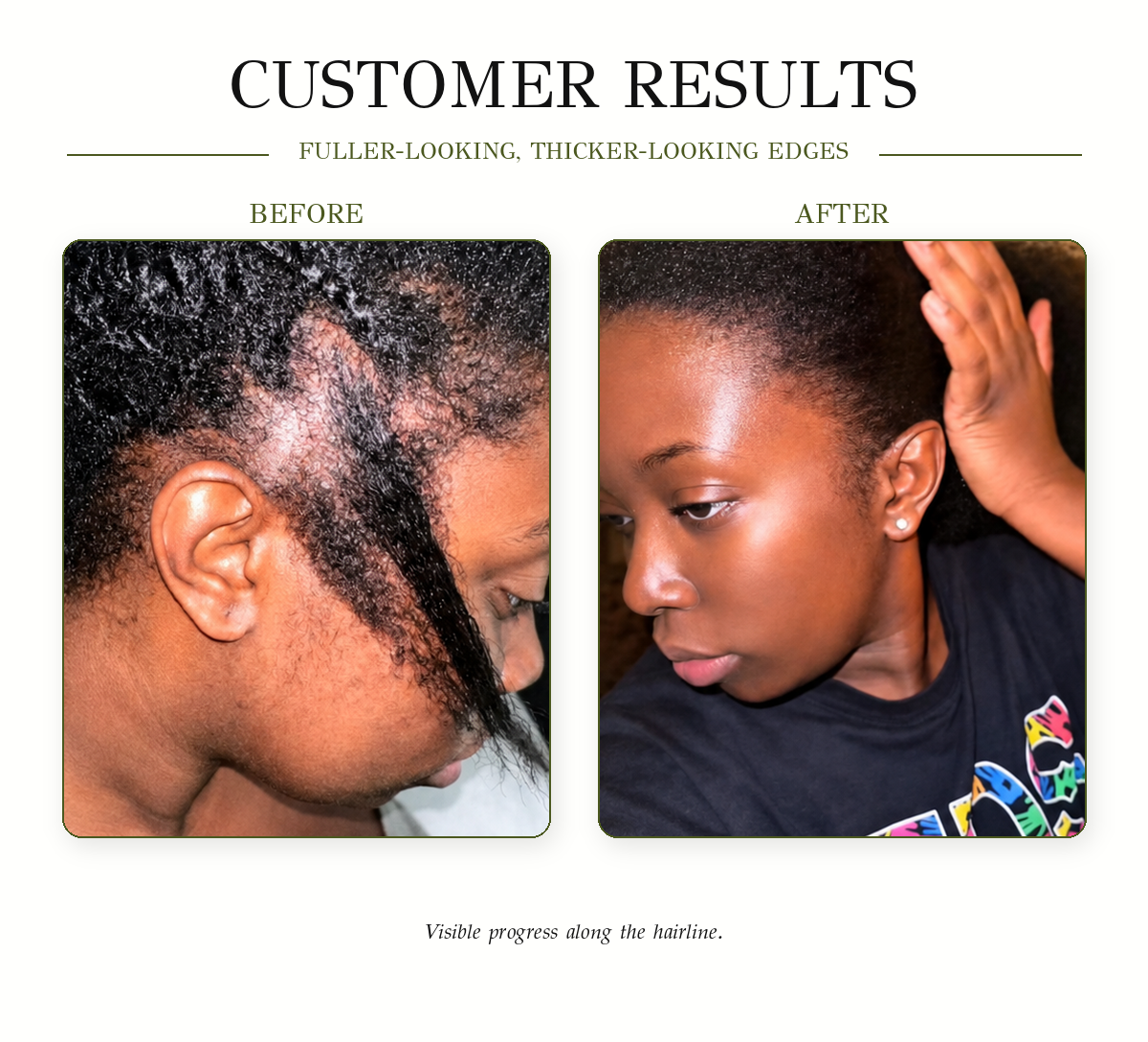 A promotional graphic titled 'CUSTOMER RESULTS' showing before-and-after hairline and scalp photos of a person. The left panel labeled 'BEFORE' shows a visible hairline and textured hair, while the right panel labeled 'AFTER' shows a fuller-looking hairline and smoother scalp.